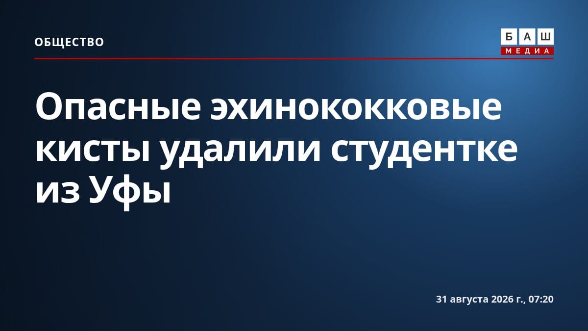Опасные эхинококковые кисты удалили студентке из Уфы